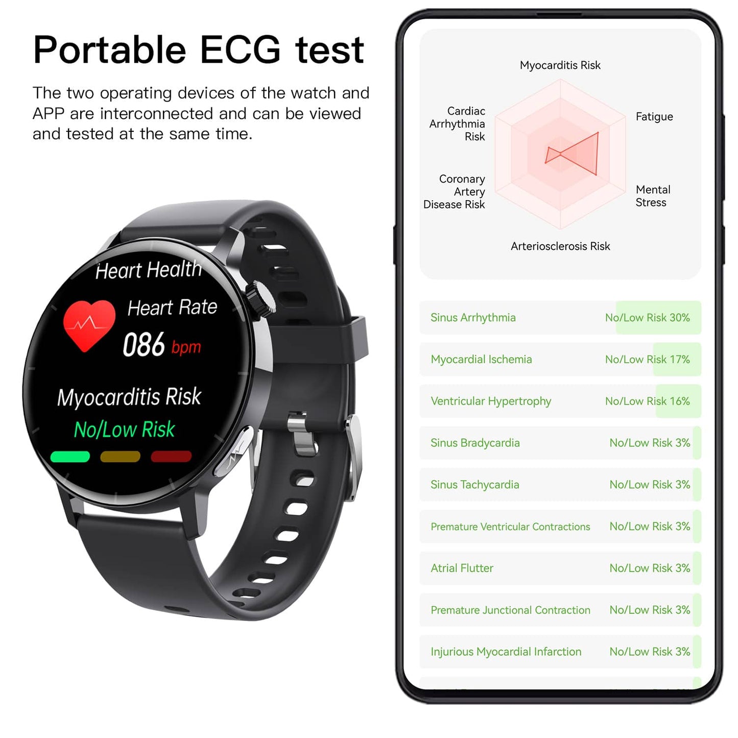 ZWPRO Fourth-generation Blood Sugar Blood Pressure ECG/EKG Smart Watch